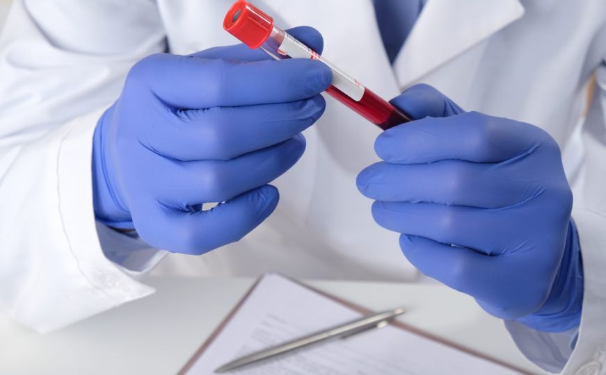 Briga o zdravlju: Besplatno, anonimno i povjerljivo testiranje na HIV dostupno tokom cijele godine