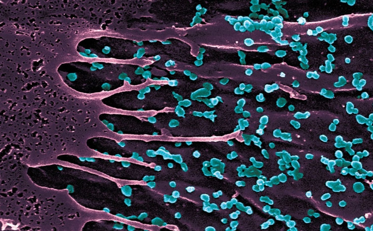 WHO upozorio na epidemiju virusa: Potrebna hitna akcija kako bi se spriječilo ponavljanje historije!
