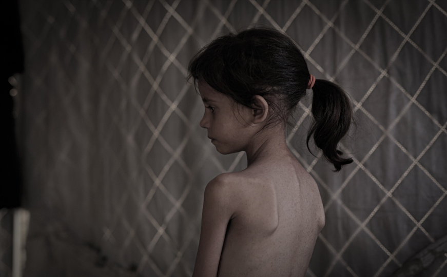 Humanitarni let iz Jordana: Španija evakuiše teško bolesnu djecu iz Gaze