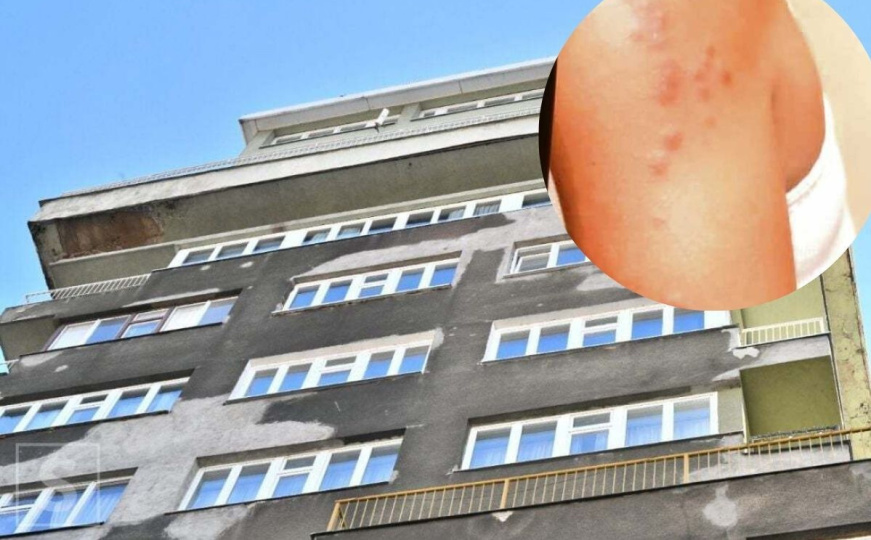 Stjenice sve češće u stanovima u Sarajevu: Šta kažu građani, a šta savjetuju stručnjaci?