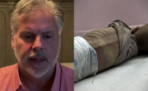 Američki doktor koji se vratio iz Gaze: "Djeca tamo izgledaju kao zombiji"