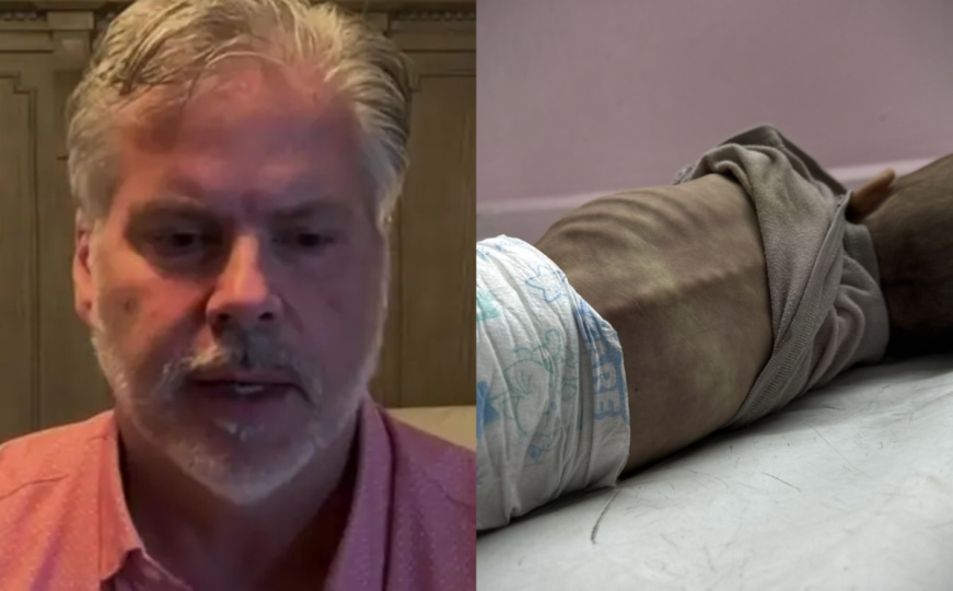 Američki doktor koji se vratio iz Gaze: "Djeca tamo izgledaju kao zombiji"