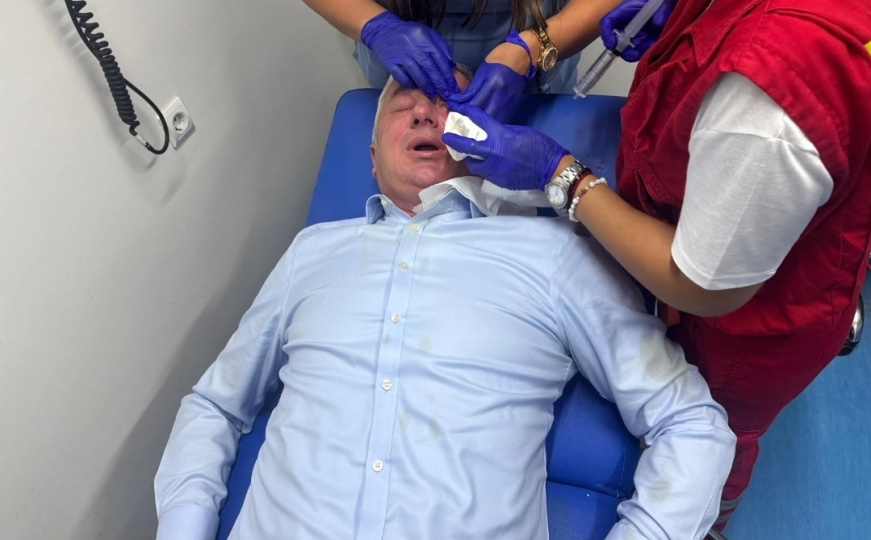 Borenović večeras napadnut pred zgradom: Policija reagovala, poslanik prebačen u bolnicu