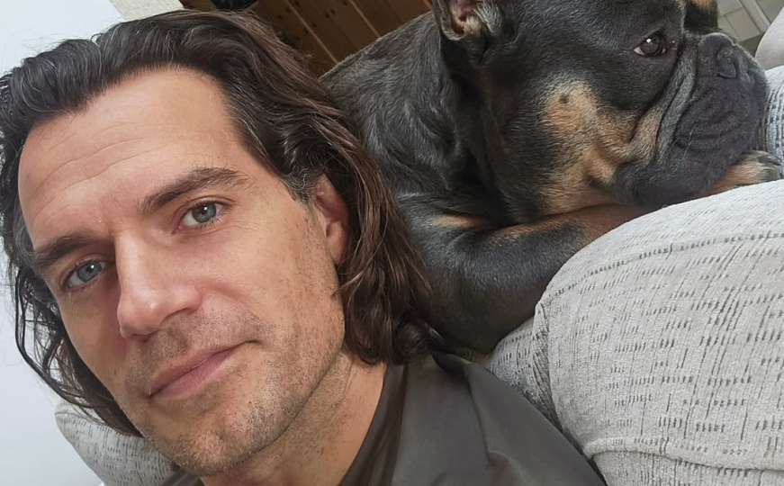 Nakon vijesti o teškoj povredi: Henry Cavill fotografijom riješio misteriju