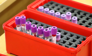 Vlada KS poziva na solidarnost: Akcijom darivanja krvi spašavamo živote zajedno