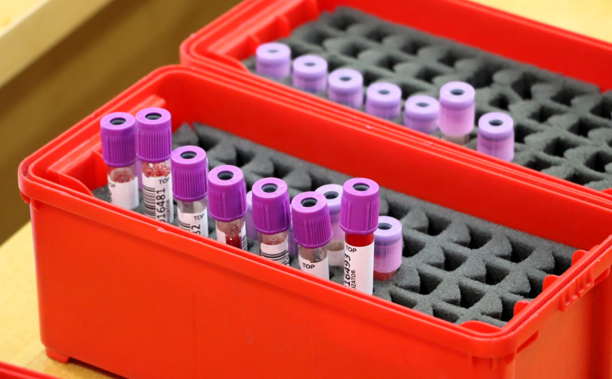 Vlada KS poziva na solidarnost: Akcijom darivanja krvi spašavamo živote zajedno