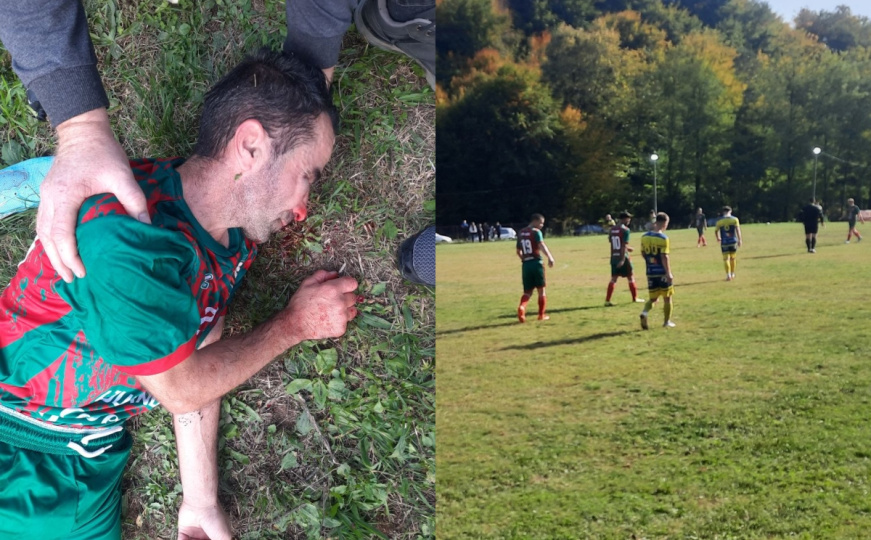 Užasne scene u nižem rangu bh. fudbala: Igrač brutalno pretučen, prijetilo se satarom i pištoljem