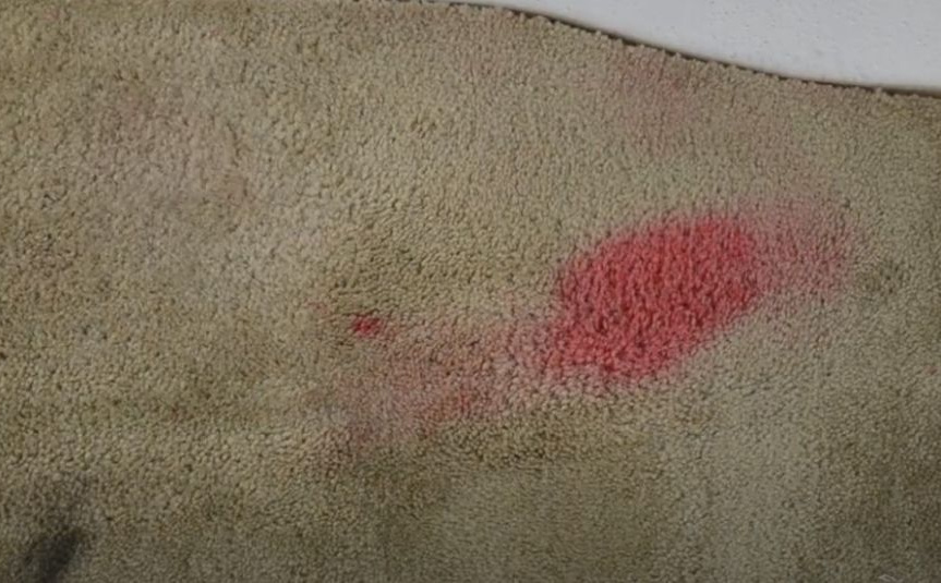 Nije sve izgubljeno: Najbolja metoda za uklanjanje tvrdokornih mrlja sa tepiha