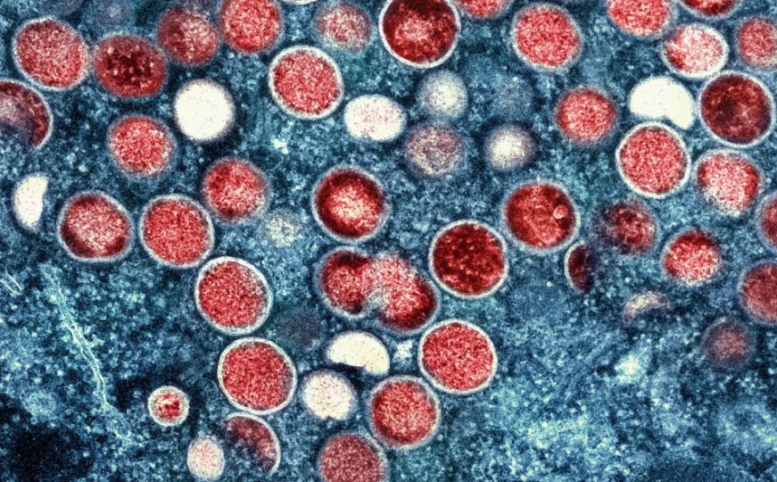 Nove zdravstvene prijetnje u Evropi: Virus zabilježen u nekoliko zemalja, stručnjaci upozoravaju