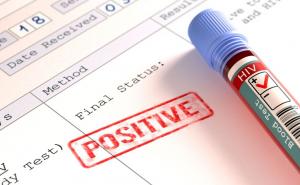 Svjetski je dan borbe protiv HIV/AIDS-a: U Mostaru besplatno testiranje