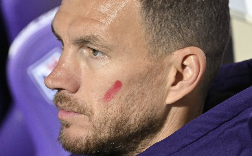 Fiorentina nastavlja tonuti: Ni Džeko nije mogao spriječiti novi poraz Viola