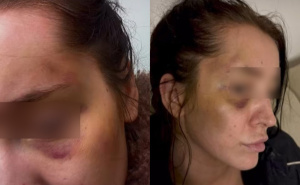 Mlada Goraždanka progovorila o nasilju: "Počeo je punim pesnicama da me udara u glavu"