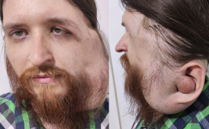 Udruženje Pomozi.ba pokrenulo apel za Jasenka Ramića: Jednim pozivom možete mu spasiti život