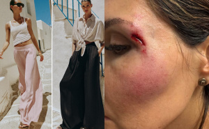 Zarine "pantalone smrti": Viralni modni hit zbog kojeg ljudi padaju i ozbiljno se povređuju