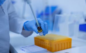 Opasan virus ponovo u Srbiji: Prvi slučajevi groznice Zapadnog Nila, ovo su simptomi