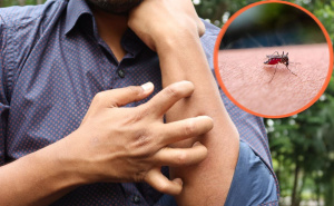 Virus Zapadnog Nila stigao u komšiluk: Provjerili smo ima li ga u BiH, stručnjak poslao važnu poruku