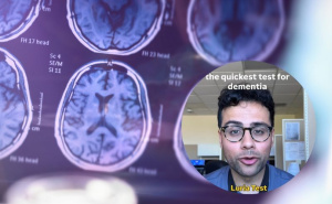 Neurolog otkriva brzi test za demenciju: Dovoljna su samo tri pokreta rukama