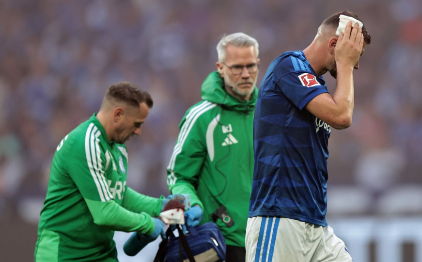 Jeziva povreda: Edin Džeko krvave glave napustio teren