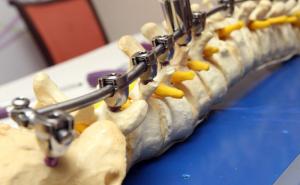  / Uloga medicinskih sestara značajna u procesu zbrinjavanja neurohirurških bolesnika, FOTO: Fena