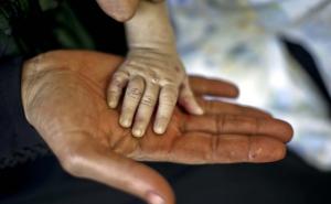 Foto: AA / Siromaštvo/ Ilustracija