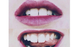  / Kad se uljepšavanje pretvori u 'horor', FOTO: Buzzfeed