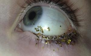  / Kad se uljepšavanje pretvori u 'horor', FOTO: Buzzfeed