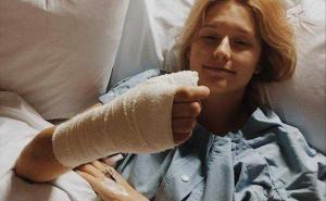 Foto: Daily Mail / Courtney Whithorn ostala je bez prsta i dva limfna čvora