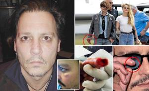 Foto: Daily Mail / Depp tvrdi da je on bio žrtva