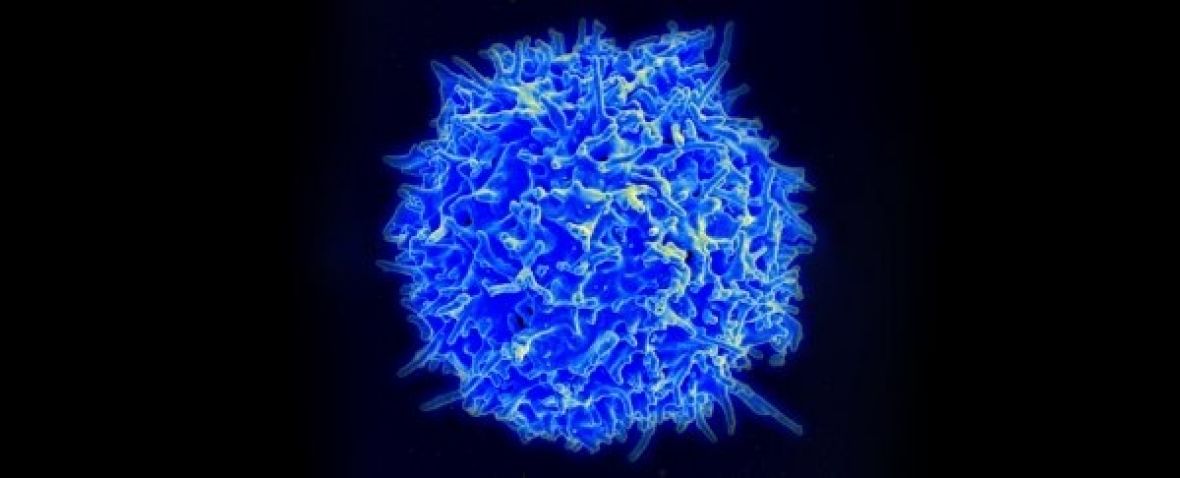 T ćelija - undefined