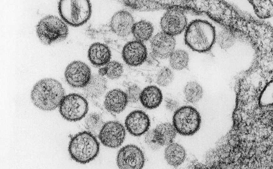 Hantavirus