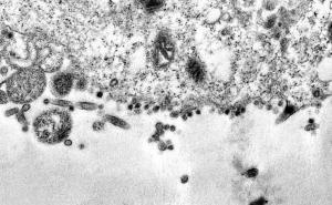 Foto: EPA-EFE / Čestice pokušavaju ući u citoplazmu stanice