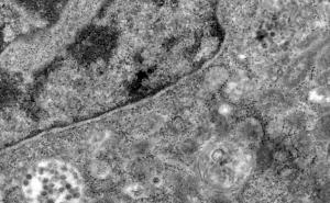 Foto: EPA-EFE / Virusne čestice unutar stanice