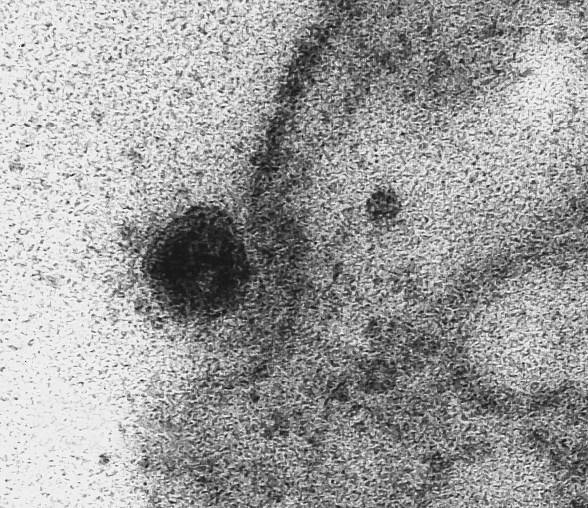Prikaz napada koronavirusa - undefined