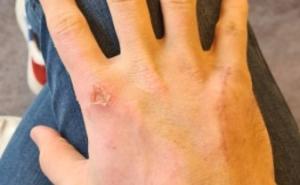 Foto: Prtscr/Instagram / Ruke Grosjeana nakon nesreće