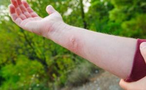 Foto: Unsplash / Ubod stršljena / Ilustracija