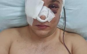Foto: Ivan Andrijanić / Povrede koje je dobio tokom proslave
