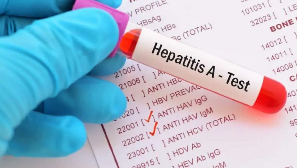 Hrvatska /U regiji se pojavila epidemija hepatitisa A, uglavnom zaraženi srednjoškolci / Radio Sarajevo