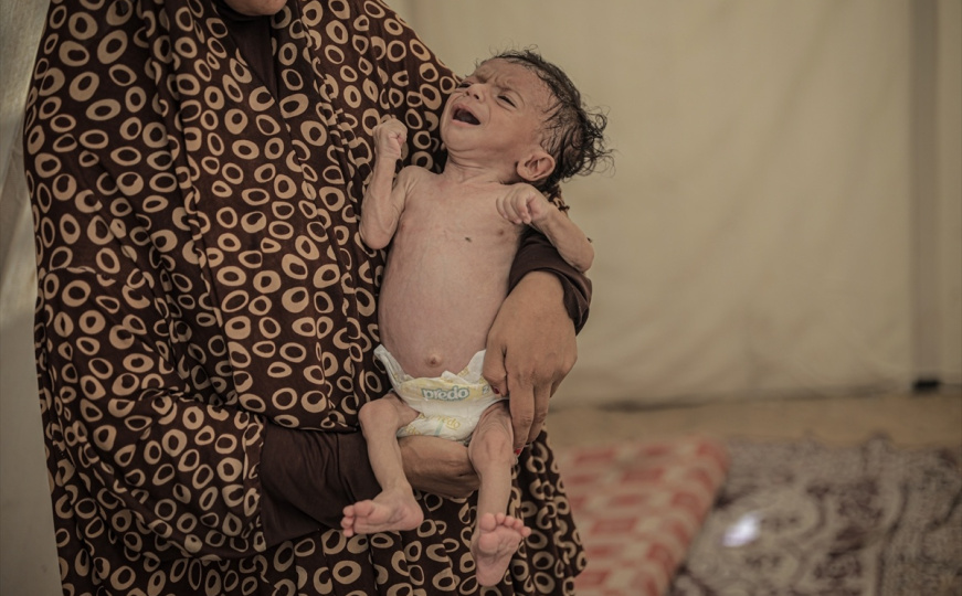 Pothranjena djeca u Gazi