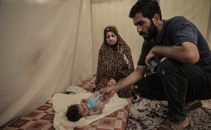 Foto: AA / Pothranjena djeca u Gazi