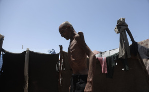 Foto: AA / Palestinac izgubio težinu zbog gladi