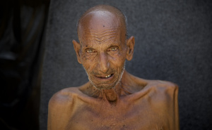 Foto: AA / Palestinac izgubio težinu zbog gladi