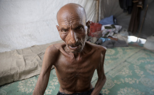 Foto: AA / Palestinac izgubio težinu zbog gladi