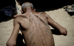 Foto: AA / Palestinac izgubio težinu zbog gladi