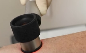 Foto: Screenshot / Dermatološki pregled / Ilustracija