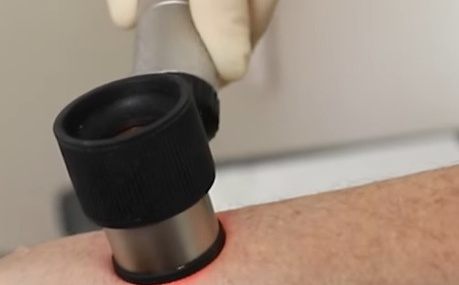 Dermatološki pregled / Ilustracija