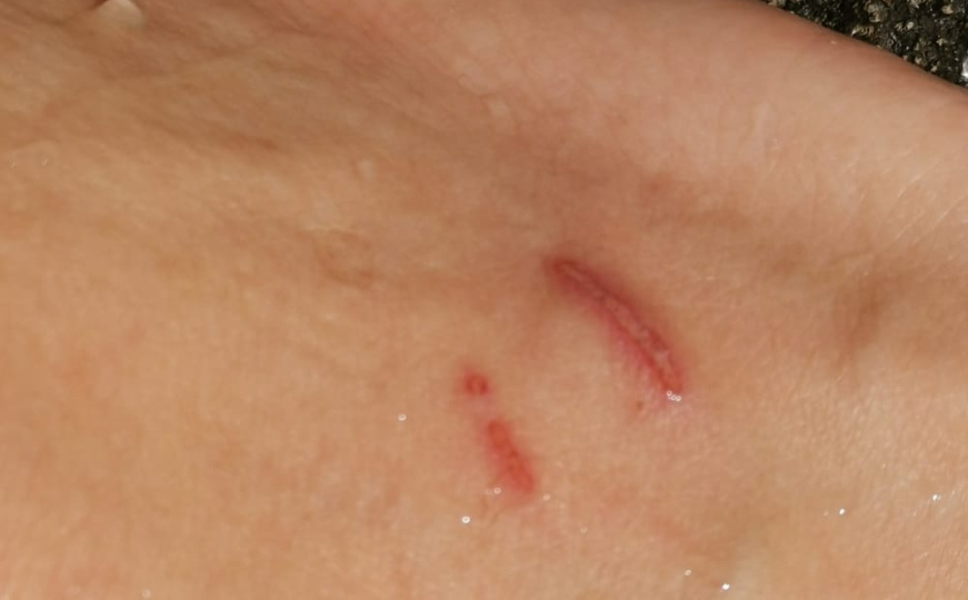 Rana nakon udara drhtulje