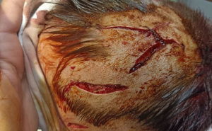 Foto: Ustupljena fotografija / Povrede koje je pas lutalica nanio maloljetniku