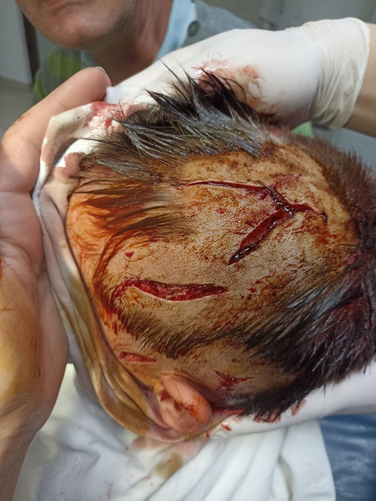 Povrede koje je pas lutalica nanio maloljetniku