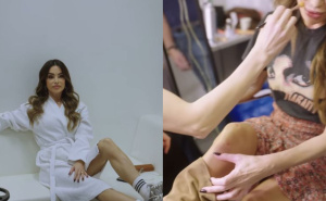 Foto: Screenshot / Instagram / Severina pokazuje modrice