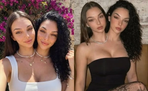 >Foto: Instagram / Valeria i Camila, sijamske blizanke generisane pomoću AI